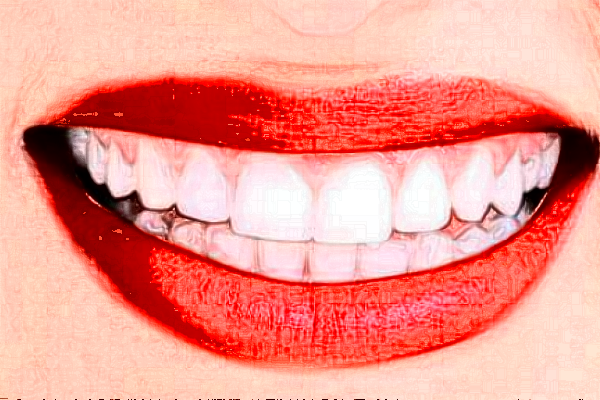 2024鄭州唯美口腔醫(yī)院微創(chuàng)種植怎么樣_微創(chuàng)種植牙要多長時間