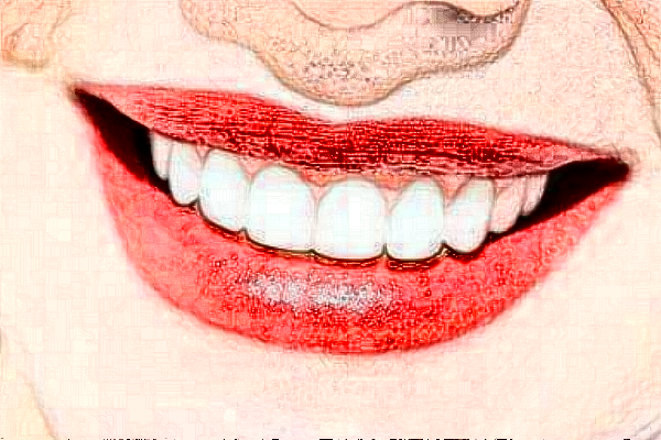 2024鄭州唯美口腔醫(yī)院微創(chuàng)種植怎么樣_微創(chuàng)種植牙要多長時間