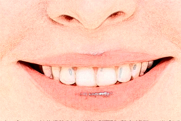 重慶團圓口腔醫(yī)院補牙好不好?補牙醫(yī)生推薦名單