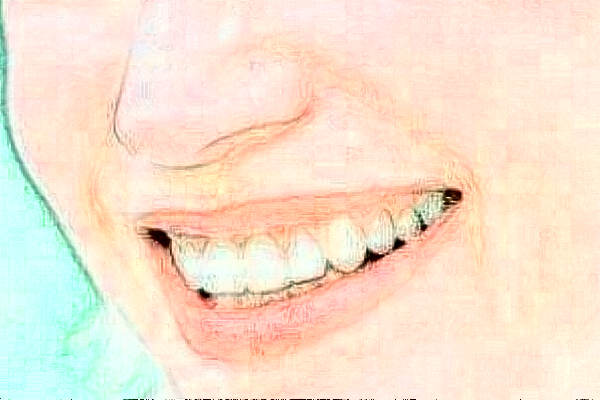 2024山東鉑爾口腔全瓷牙哪個(gè)醫(yī)生好?專家名單+案例反饋