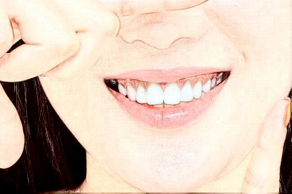 2024山東鉑爾口腔全瓷牙哪個(gè)醫(yī)生好?專家名單+案例反饋