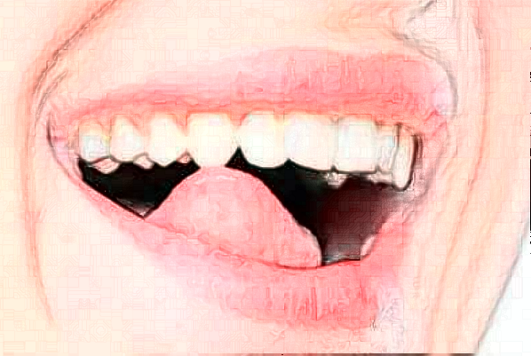 淮安諾貝爾口腔醫(yī)院全口種植怎么樣，附醫(yī)生信息一覽~