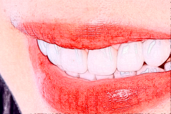 2024淮安諾貝爾口腔醫(yī)院根管好不好?附術后案例參考!