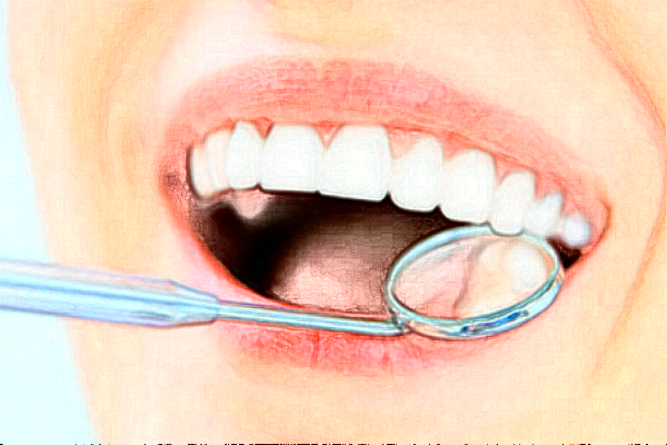 2024淮安諾貝爾口腔醫(yī)院根管好不好?附術后案例參考!