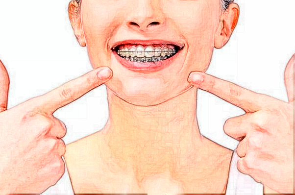 杭州植得口腔門(mén)診部牙齒美白好的醫(yī)生推薦_美容日記展示