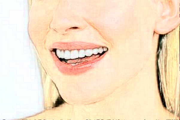 2024杭州雅萊口腔瓷貼面價(jià)格來咯!還有案例可以參考