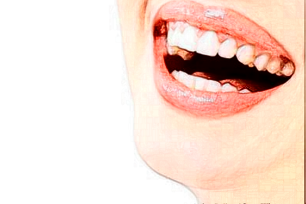 2024太原眾牙口腔醫(yī)院怎么樣？值得去嗎