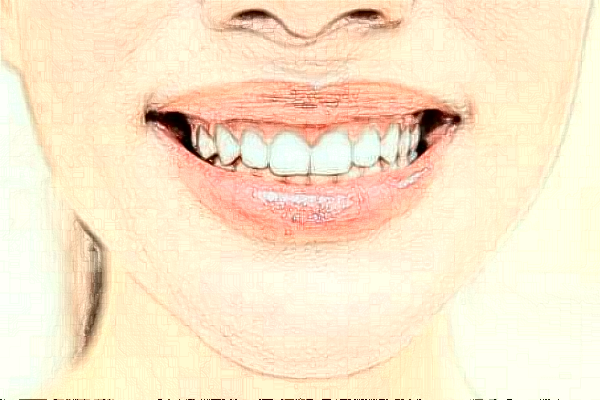 襄陽(yáng)新德恩口腔門診部全口牙種植怎么樣_誰(shuí)做得好