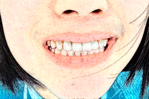 長沙好大夫口腔醫(yī)院半口牙種植好的大夫?醫(yī)生簡介