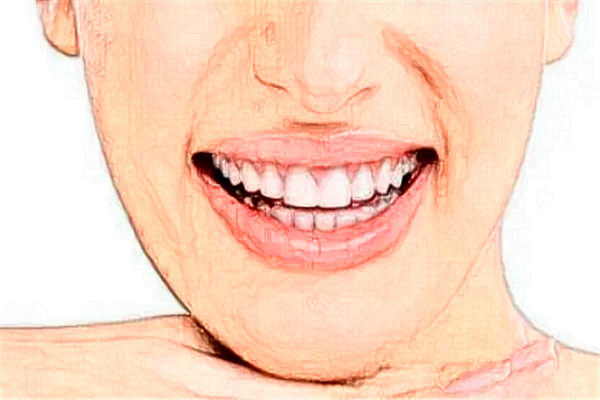 成都圣貝牙科醫(yī)院美容冠價格多少?整形日記全過程分享