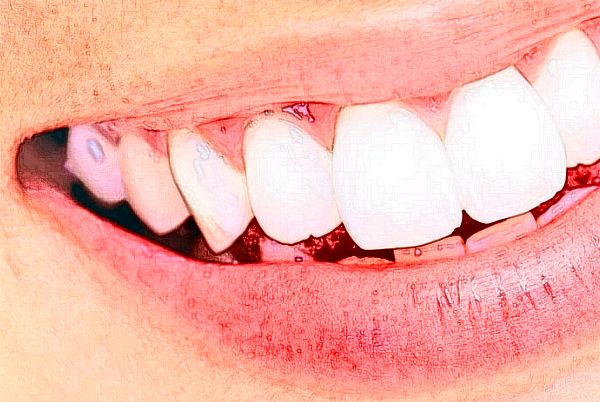 2024淮安諾貝爾口腔醫(yī)院皓齒美白做的好嗎?案例欣賞+醫(yī)生名單!