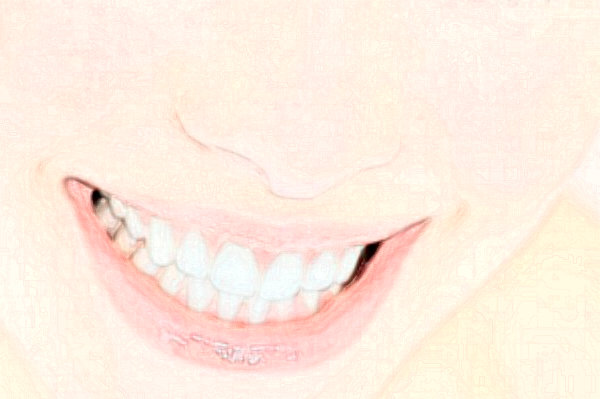 2024成都茁悅口腔拔牙好嗎_真實案例發(fā)布