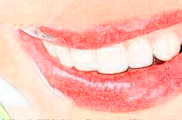 山東鉑爾口腔種植牙做的好嗎?案例欣賞+醫(yī)生名單!