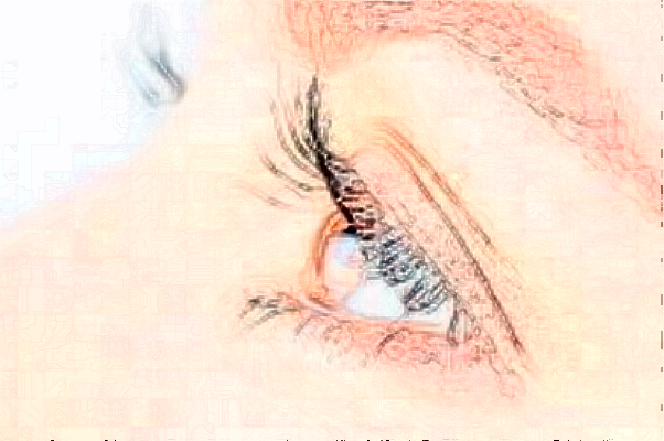 2024遼寧省人民醫(yī)院全飛秒費(fèi)用多少?整形日記全過(guò)程