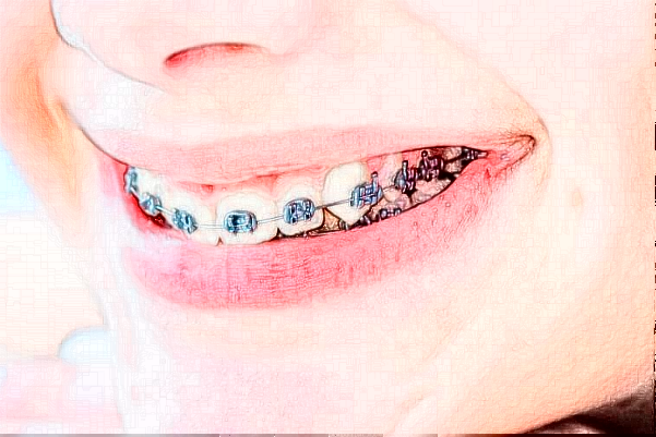 2024山東鉑爾口腔全口種植哪個醫(yī)生好?專家名單+案例反饋