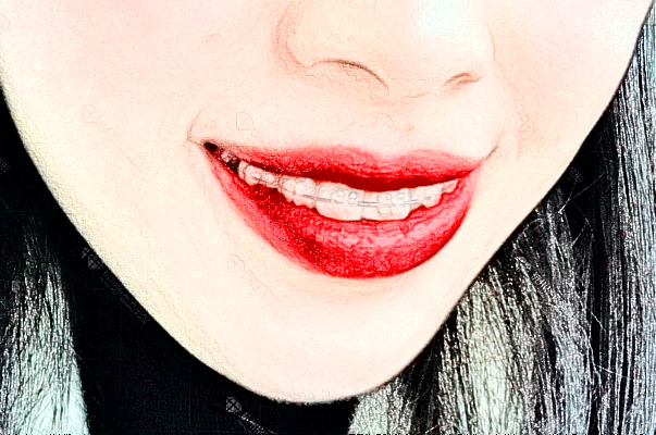 中山香山口腔醫(yī)院拔智齒疼嗎?有沒有什么危險(xiǎn)?