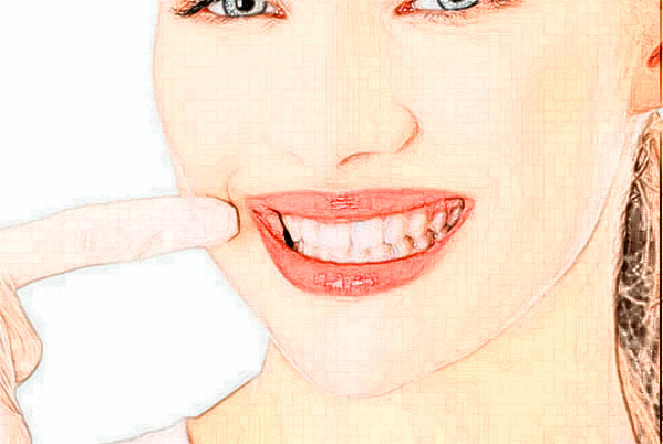 河南美奧口腔醫(yī)院烤瓷牙怎么安裝?烤瓷牙的壽命多久