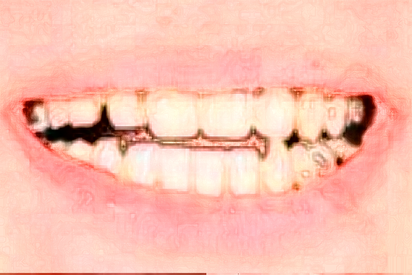 深圳樂莎莎口腔醫(yī)院比較好的醫(yī)生?2024醫(yī)生收費(fèi)價(jià)格