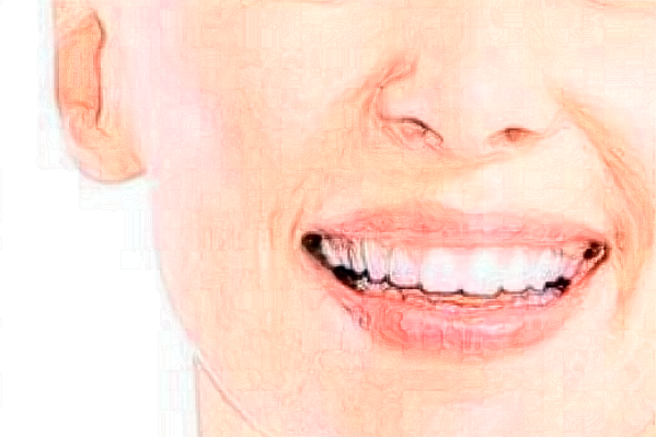 2024淮安諾貝爾口腔醫(yī)院瓷貼面哪個醫(yī)生好?專家名單+案例反饋