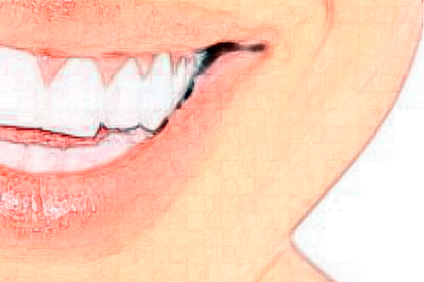 鄭州唯美口腔醫(yī)院根管怎么樣_價(jià)格表_案例_地址