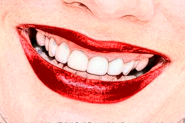 2024成都茁悅口腔皓齒美白怎么樣?醫(yī)生介紹_案例分享