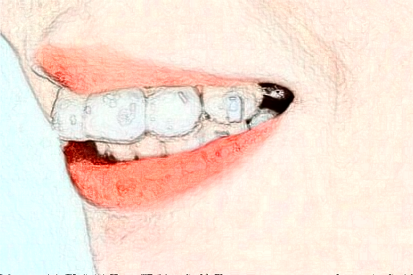 成都圣貝牙科醫(yī)院拔牙好的醫(yī)生推薦_美容日記展示