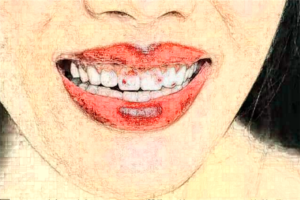 成都茁悅口腔牙齒不齊矯正怎么樣_專家信息_案例大全