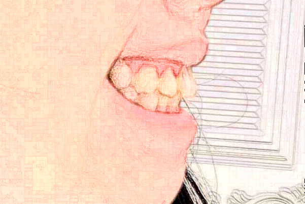 深圳樂莎莎口腔醫(yī)院醫(yī)生怎么樣?2024牙齒矯正怎么收費(fèi)