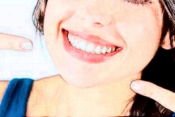 成都新橋口腔醫(yī)院根管貴不貴?2024根管費(fèi)用