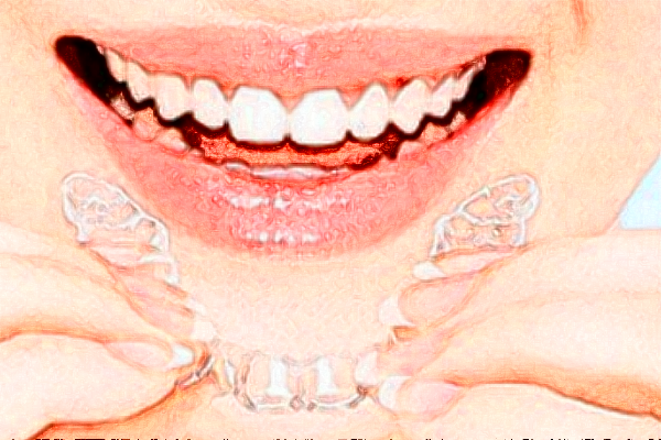 2024河南美奧口腔醫(yī)院牙齒美白價格?牙齒美白的方法