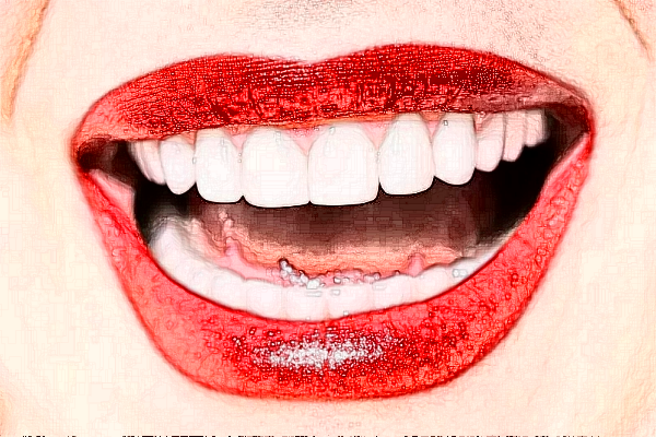 2024河南美奧口腔醫(yī)院牙齒美白價格?牙齒美白的方法