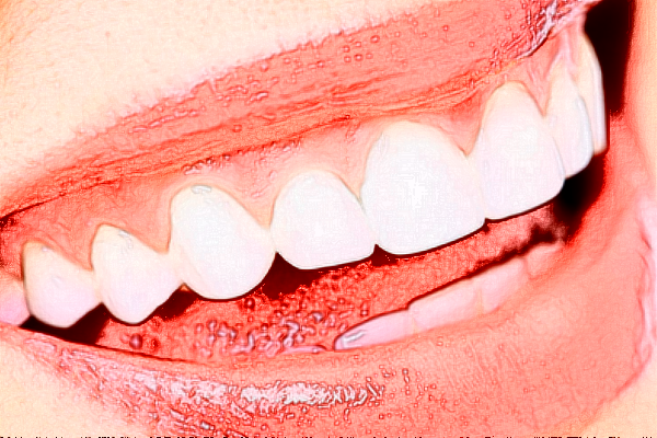 2024深圳樂莎莎口腔醫(yī)院隱形矯正價格?隱形矯正的優(yōu)點