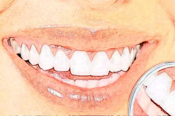 深圳樂莎莎口腔醫(yī)院有哪些醫(yī)生?矯正牙齒的醫(yī)生案例