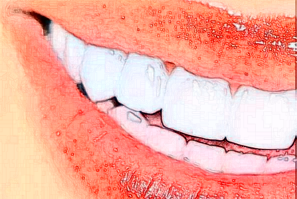 2024貴陽柏德口腔醫(yī)院前牙種植費(fèi)用多少?整形日記全過程