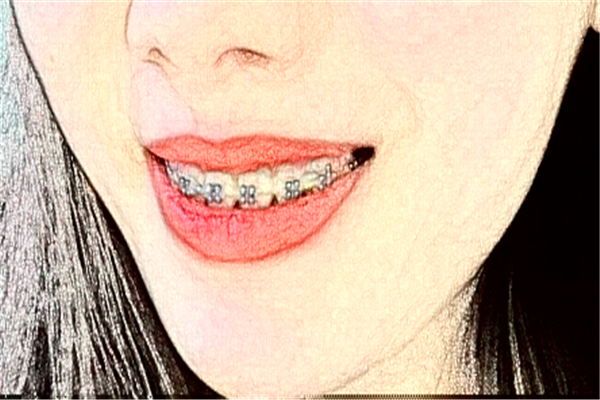 2024杭州雅萊口腔牙綜合怎么樣?哪個(gè)醫(yī)生好