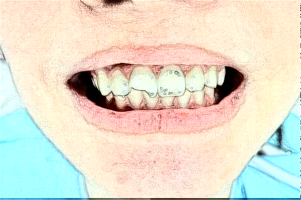 2024杭州雅萊口腔牙綜合怎么樣?哪個(gè)醫(yī)生好