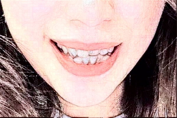 福州福能海峽口腔醫(yī)院正畸價目表(價格表)怎么樣