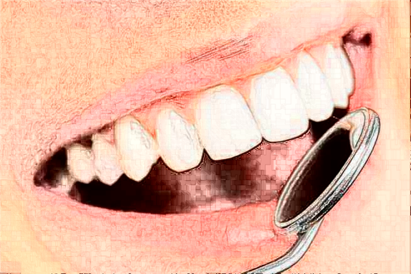 重慶齊美口腔門診部烤瓷牙價目表(價格表)_口碑怎么樣