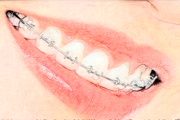 山西省人民醫(yī)院自鎖矯正好的大夫有誰?醫(yī)生簡介