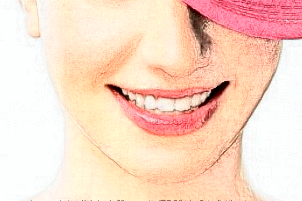 2024深圳樂莎莎口腔醫(yī)院補牙價格?補牙痛不痛?