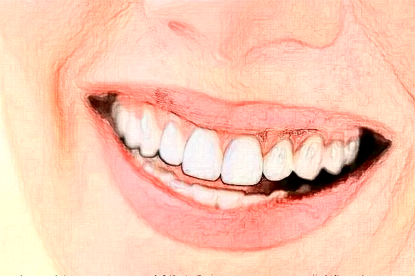 2024宣城大醫(yī)醫(yī)院牙齒矯正多少錢(qián)?牙齒矯正后遺癥和危害