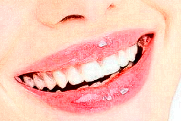 2024義烏傅氏口腔門(mén)診部隱形矯正多少錢(qián)?隱形矯正案例