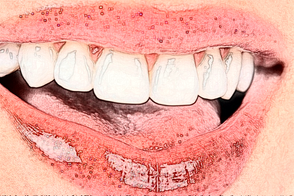 義烏傅氏口腔門診部拔智齒貴嗎?拔智齒可以瘦臉嗎