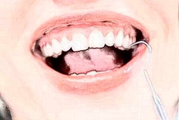 淮安諾貝爾口腔醫(yī)院正畸怎么樣?哪個醫(yī)生好+價格