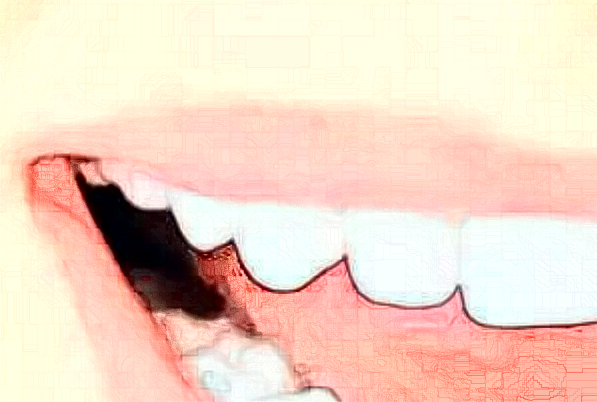 贛州貝殼口腔口腔修復(fù)怎么樣，附醫(yī)生信息一覽~