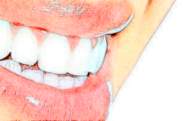 杭州植得口腔門(mén)診部前牙種植怎么樣?醫(yī)生介紹_案例分享