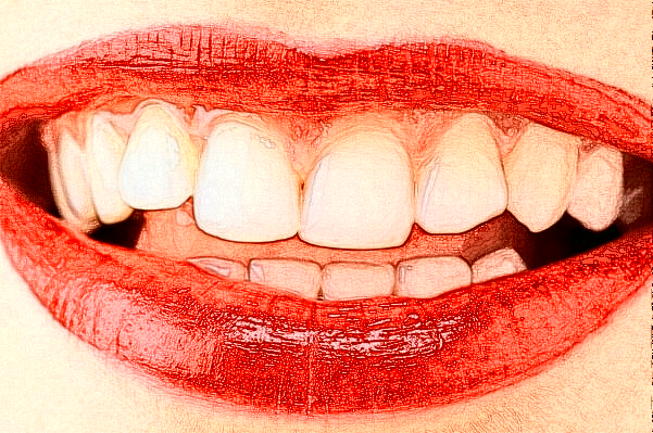 2024贛州貝殼口腔鑲牙怎么收費(fèi)?哪個(gè)醫(yī)生做得好