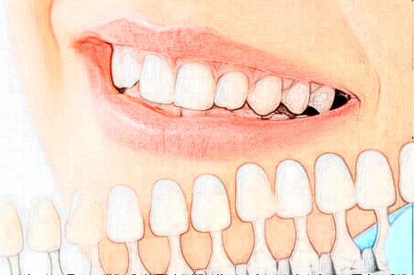 成都茁悅口腔牙體牙髓好嗎_真實(shí)案例發(fā)布