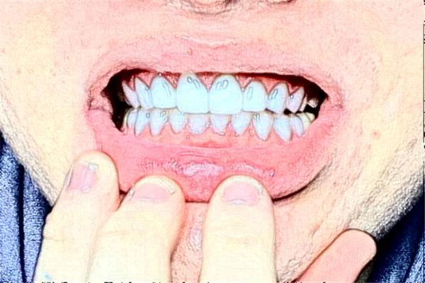 福州登特口腔醫(yī)院補(bǔ)牙好的大夫?醫(yī)生簡介