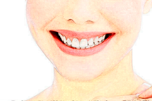 杭州植得口腔門診部正畸怎么樣|價格|案例